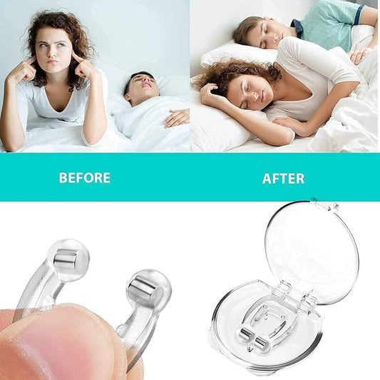 Clip Nasal Antirronquidos – Corrector de Sueño para Hombres y Mujeres